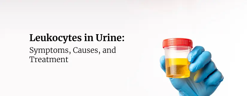 Read more about the article Leukocytes in Urine: Symptoms, Causes, and Treatment
